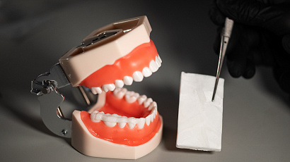 Стоп, кариес: в НИТУ МИСИС предложили новое решение для лечения зубов